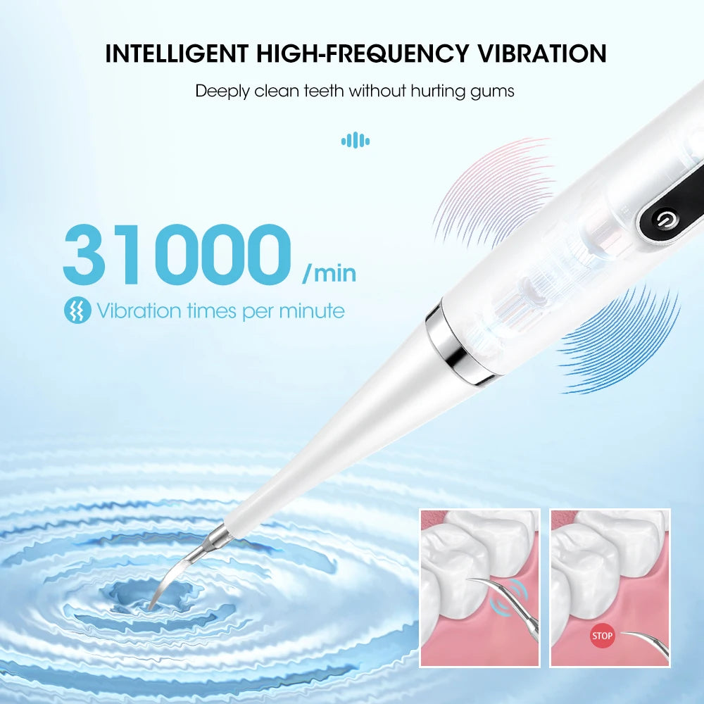 Electric Teeth Whitening Dental Calculus Scaler Plaque
