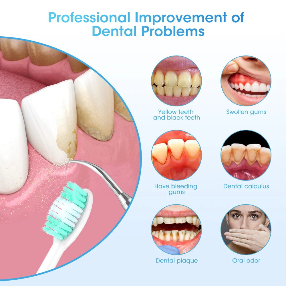 Electric Teeth Whitening Dental Calculus Scaler Plaque